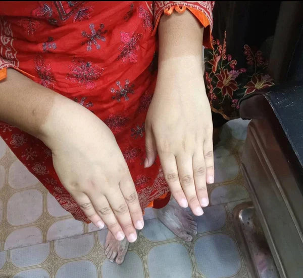 Platinum Whitening Skin Polish Kit With 100% Results (Mercury Free)