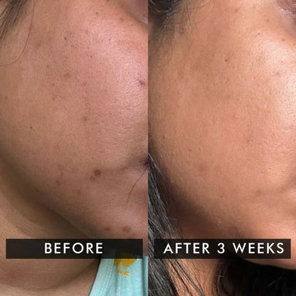 Pigma Care - Glowing and Repairing Cream