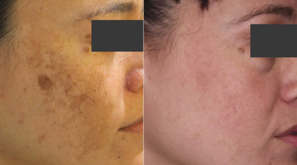 Pigma Care - Glowing and Repairing Cream