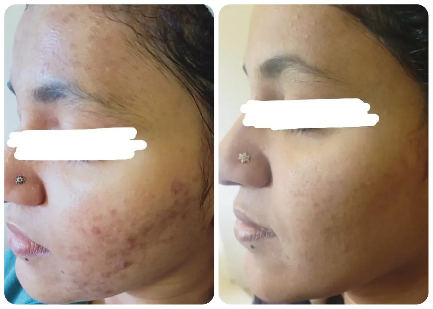 Pigma Care - Glowing and Repairing Cream